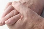 Шест биомаркера прогнозират сърдечносъдовия риск при хора с ревматоиден артрит